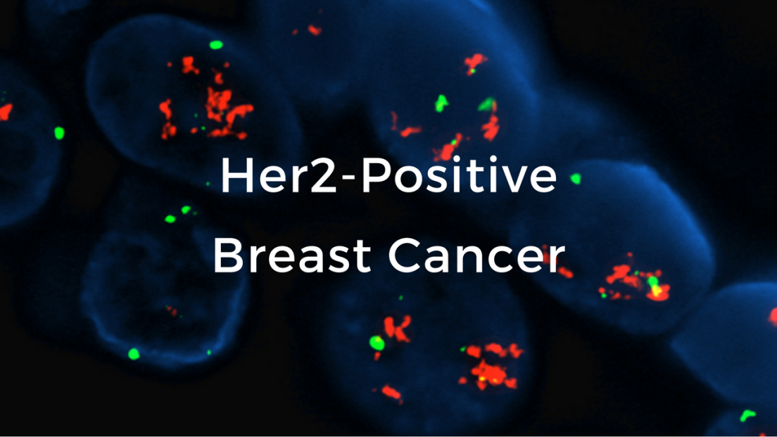 Breast Cancer Basics Video Course: Breast Cancer School For Patients