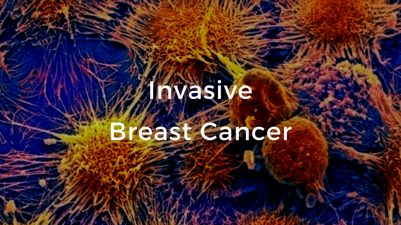 invasive-breast-cancer-the-breast-cancer-school-for-patients