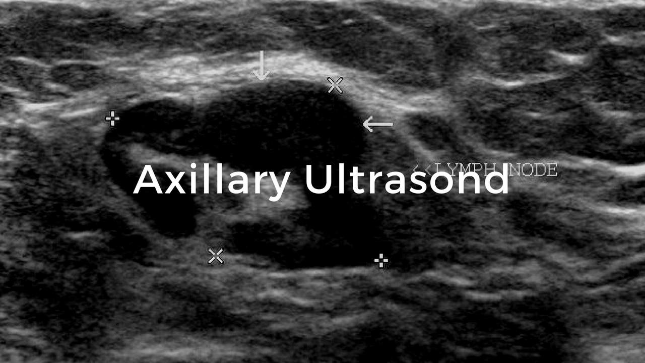 Axillary Ultrasound: Breast Cancer School For Patients